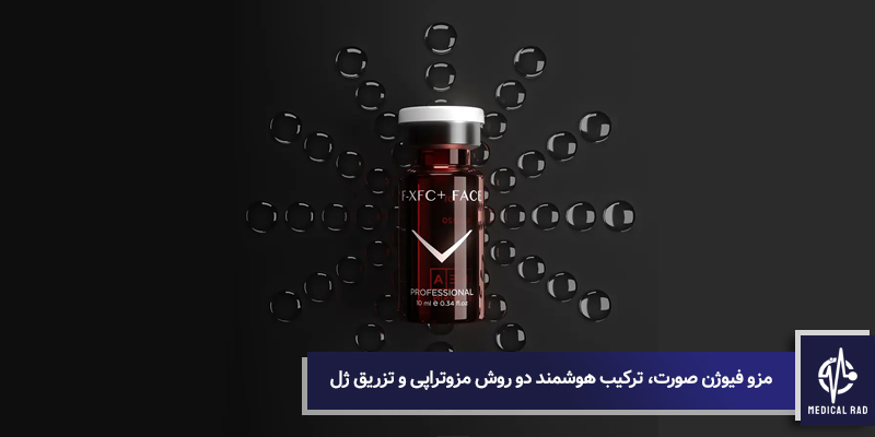 مزو فیوژن صورت