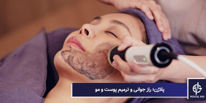 پلاژن