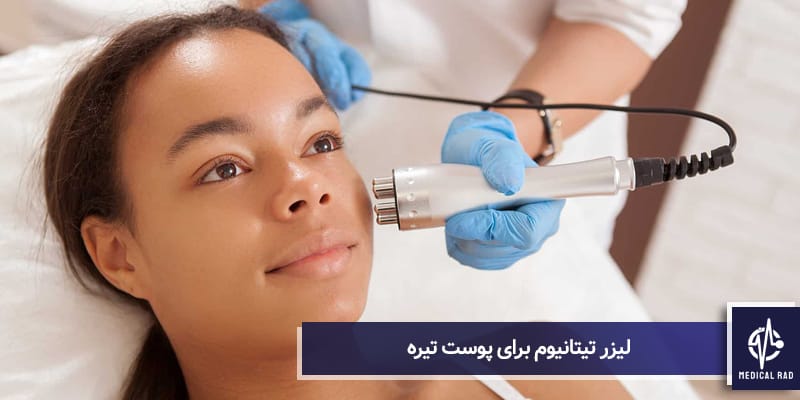 لیزر تیتانیوم برای پوست تیره