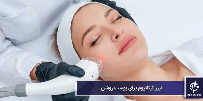 لیزر تیتانیوم برای پوست روشن