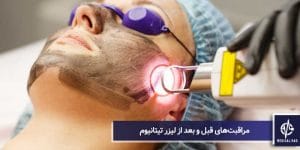 مراقبت‌های قبل و بعد از لیزر تیتانیوم